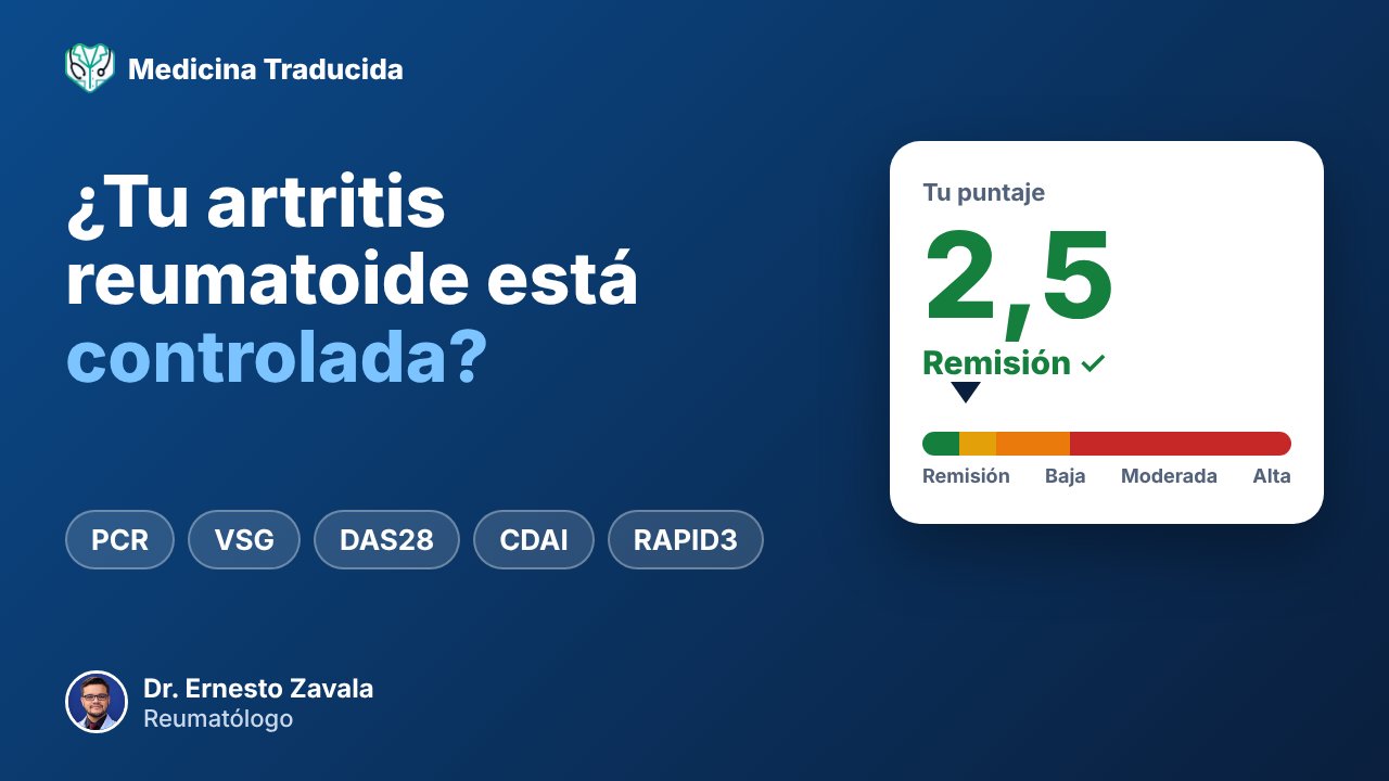 ¿Cómo saber si tu artritis reumatoide está controlada?